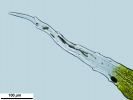 Racomitrium microcarpon