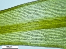Racomitrium microcarpon