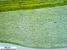 Racomitrium microcarpon
