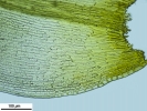 Racomitrium microcarpon