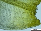 Racomitrium microcarpon