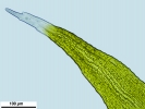 Racomitrium microcarpon
