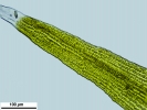 Racomitrium microcarpon