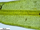 Racomitrium microcarpon