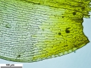 Racomitrium microcarpon