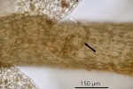 Pedinophyllum interruptum