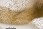 Pedinophyllum interruptum