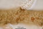 Pedinophyllum interruptum