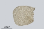 Pedinophyllum interruptum