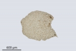 Pedinophyllum interruptum