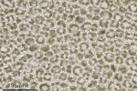 Pedinophyllum interruptum