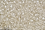 Pedinophyllum interruptum