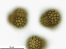 Sphaerocarpos michelii