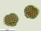 Sphaerocarpos michelii