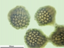 Sphaerocarpos michelii
