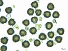 Sphaerocarpos europaeus