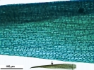 Campylopus gracilis