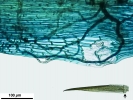 Campylopus gracilis