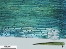 Campylopus gracilis