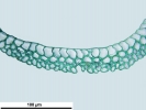 Campylopus gracilis