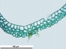 Campylopus gracilis