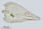 Eurhynchiastrum diversifolium