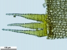 Arvernella microclada