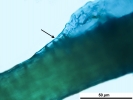 Arvernella microclada