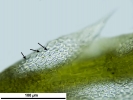 Arvernella microclada