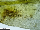 Pottiopsis caespitosa