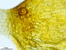 Pottiopsis caespitosa