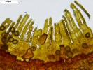 Pottiopsis caespitosa