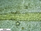 Trichostomum meridionale