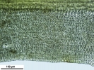 Trichostomum meridionale