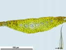 Dicranum flexicaule