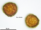 Mannia californica