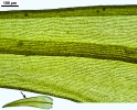 Racomitrium aquaticum