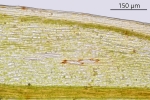 Bryum gemmiparum