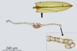 Bryum gemmiparum