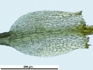 Trematodon ambiguus