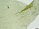 Hylocomiadelphus triquetrus